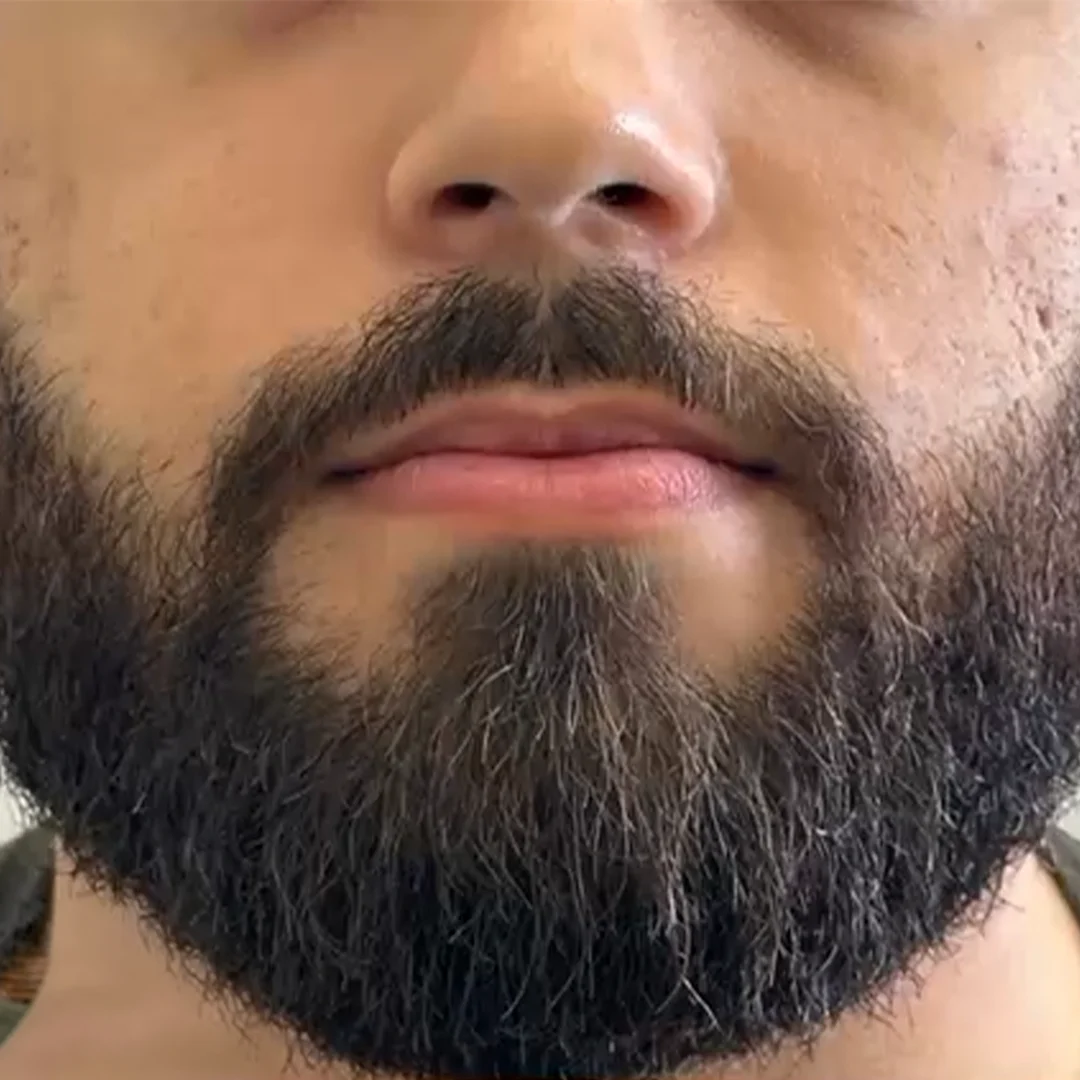 Antes